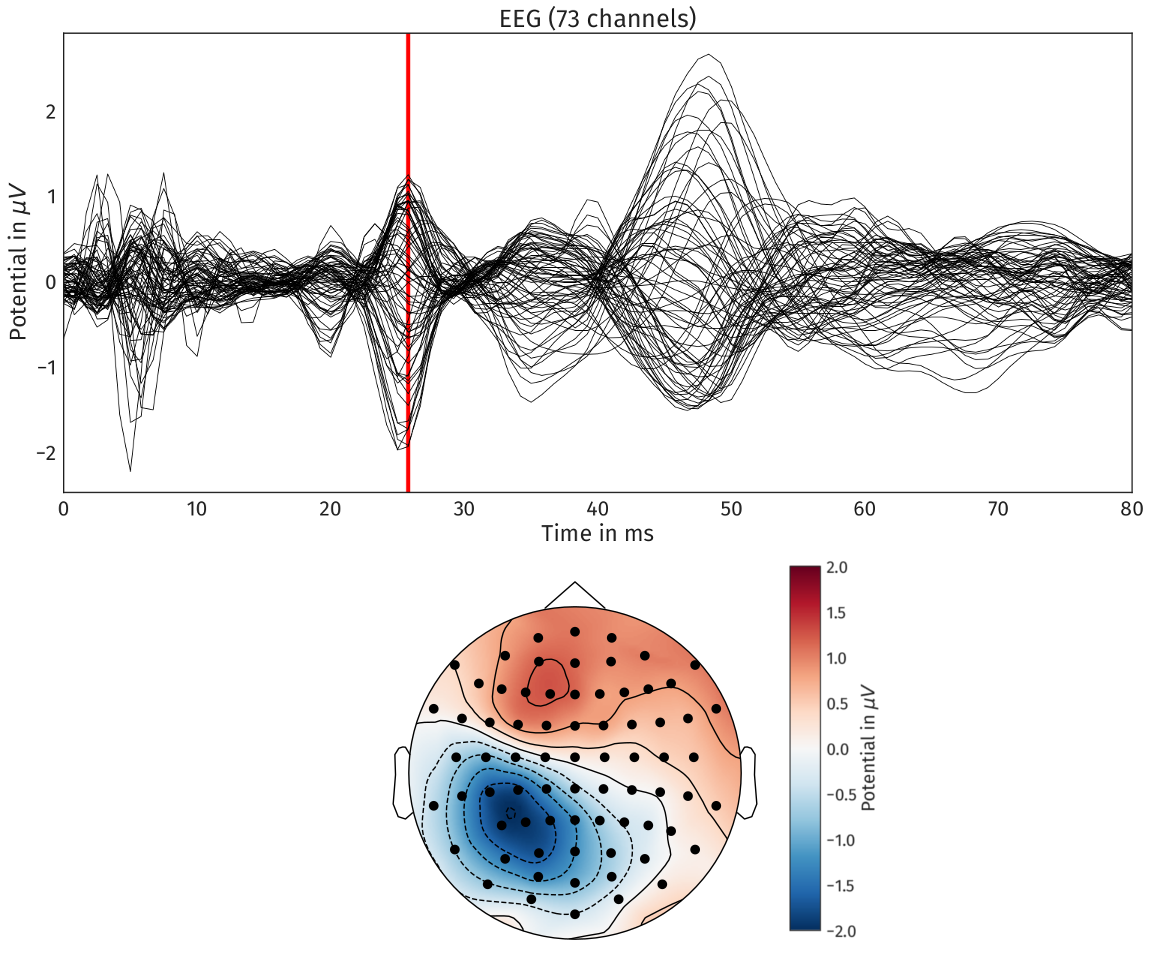 Electroencephalography Forward Problem