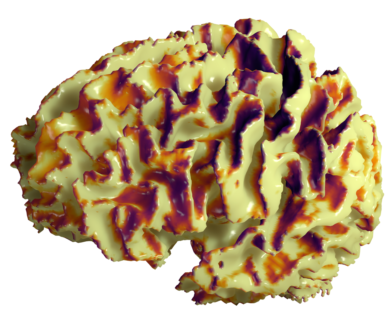 Electroencephalography Forward Problem