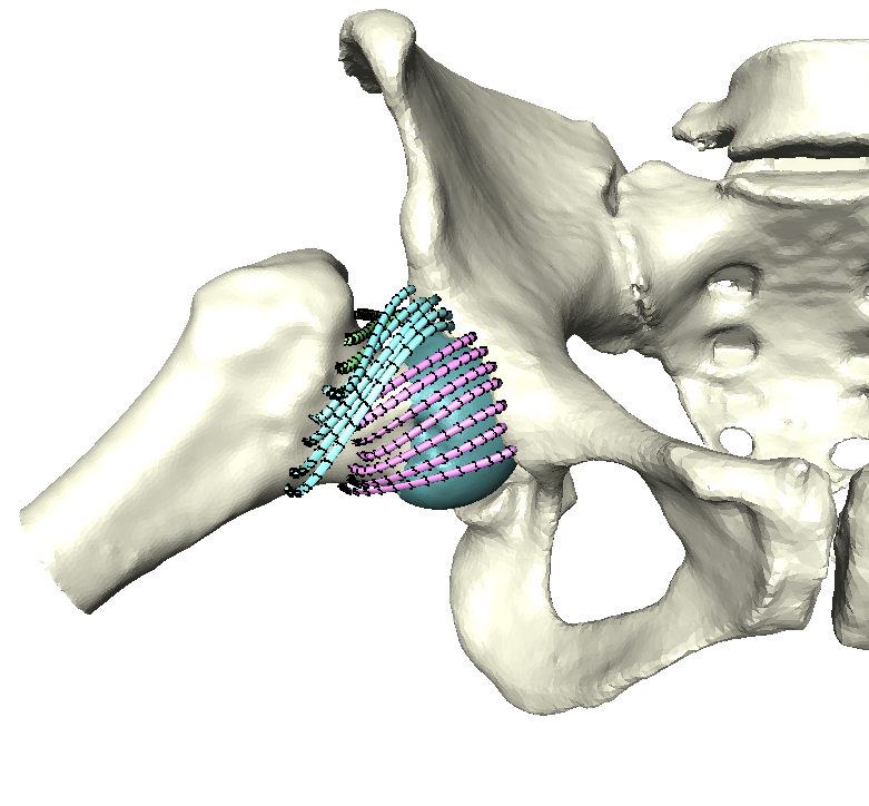 Heterogeneous hip model